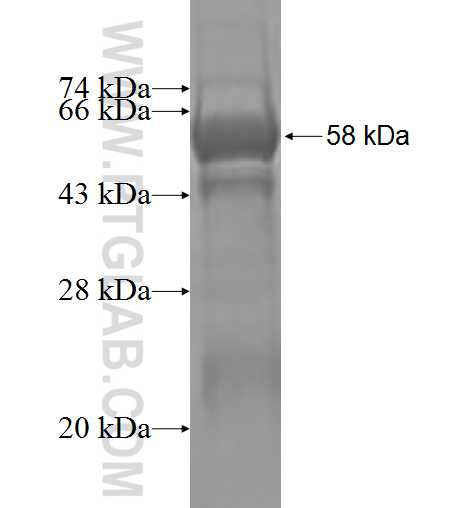 E2F6 fusion protein Ag1029 SDS-PAGE