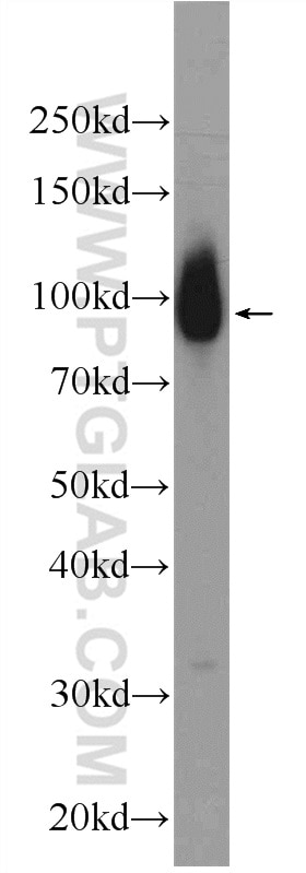 Western Blot (WB) analysis of HeLa cells using E2F7 Polyclonal antibody (24489-1-AP)