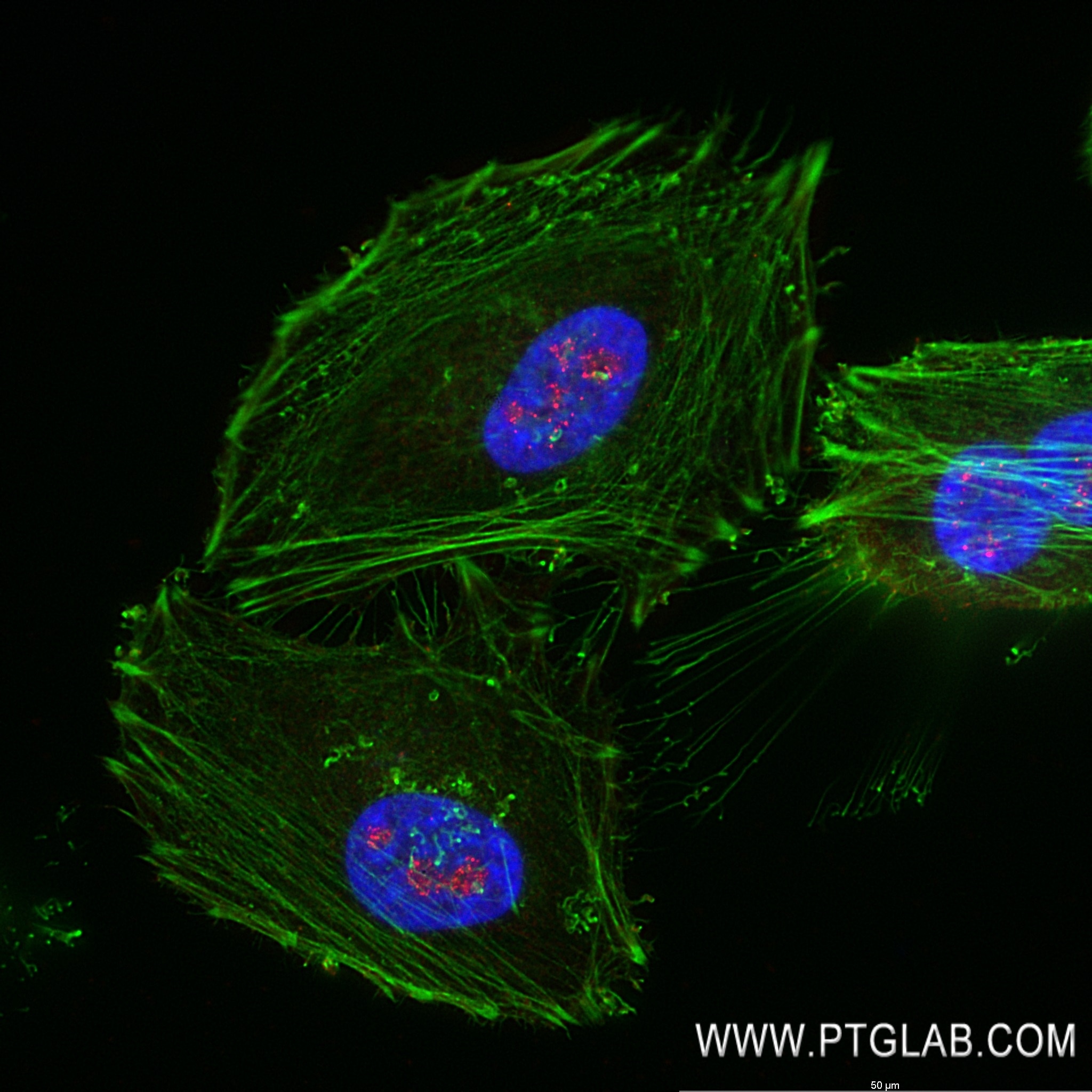Immunofluorescence (IF) / fluorescent staining of HeLa cells using E2F7 Recombinant antibody (82887-1-RR)
