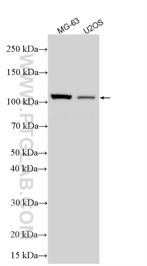 Various lysates were subjected to SDS PAGE followed by western blot with 82887-2-RR (E2F7 antibody) at dilution of 1:600 incubated at room temperature for 1.5 hours. Western Blot (WB) analysis of various lysates using E2F7 Recombinant monoclonal antibody (82887-2-RR)
