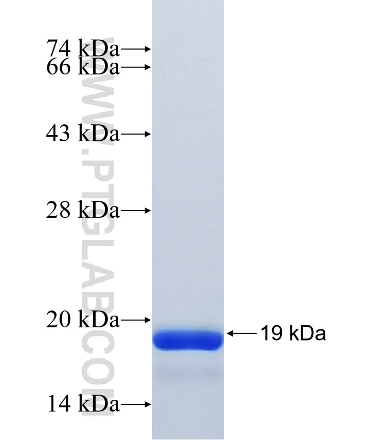 E2F7 fusion protein Ag40601 SDS-PAGE