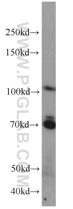 Western Blot (WB) analysis of HEK-293 cells using E2F8 Polyclonal antibody (13425-1-AP)