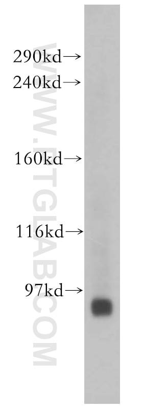 Western Blot (WB) analysis of HeLa cells using E2F8 Polyclonal antibody (13425-1-AP)