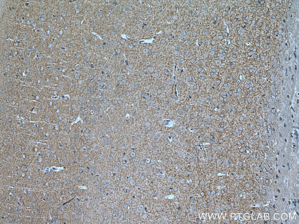 Immunohistochemistry (IHC) staining of mouse brain tissue using EAAT2 Monoclonal antibody (67083-1-Ig)