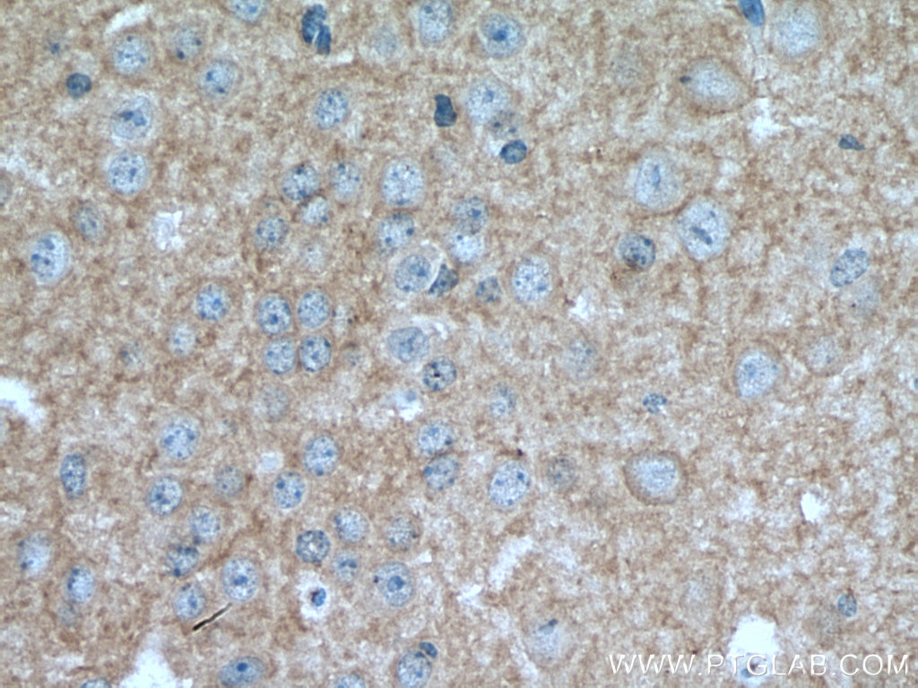 Immunohistochemistry (IHC) staining of mouse brain tissue using EAAT2 Monoclonal antibody (67083-1-Ig)