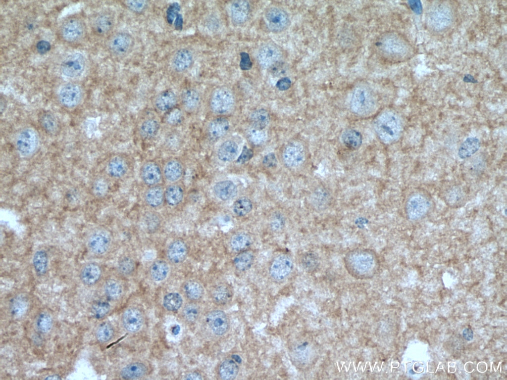 IHC staining of mouse brain using 67083-1-Ig