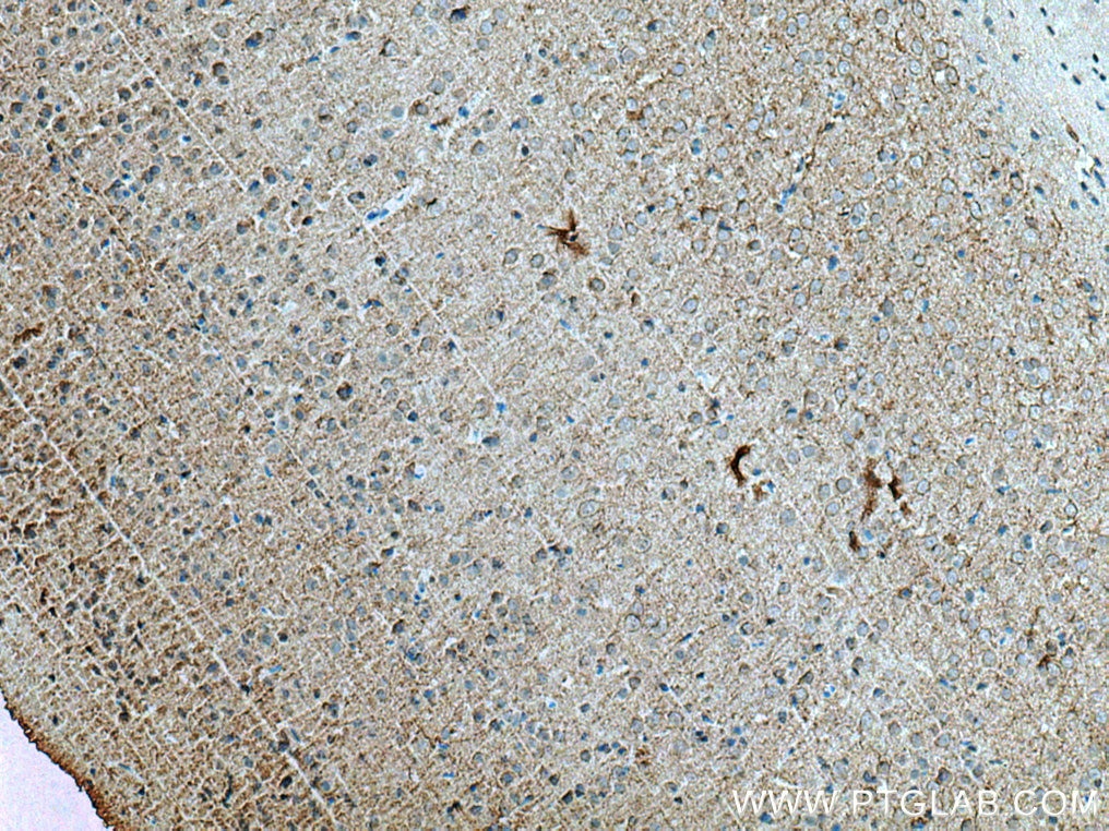 Immunohistochemistry (IHC) staining of rat brain tissue using EAAT2 Monoclonal antibody (67083-1-Ig)