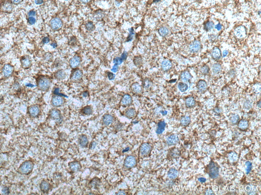 Immunohistochemistry (IHC) staining of rat brain tissue using EAAT2 Monoclonal antibody (67083-1-Ig)