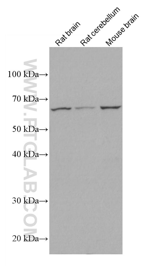 Western Blot (WB) analysis of various lysates using EAAT2 Monoclonal antibody (67083-1-Ig)