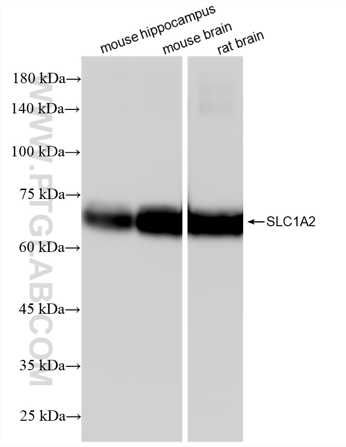 WB analysis using 88675-1-RR (same clone as 88675-1-PBS) Western Blot (WB) analysis of various lysates using EAAT2 Recombinant monoclonal antibody (88675-1-RR)
