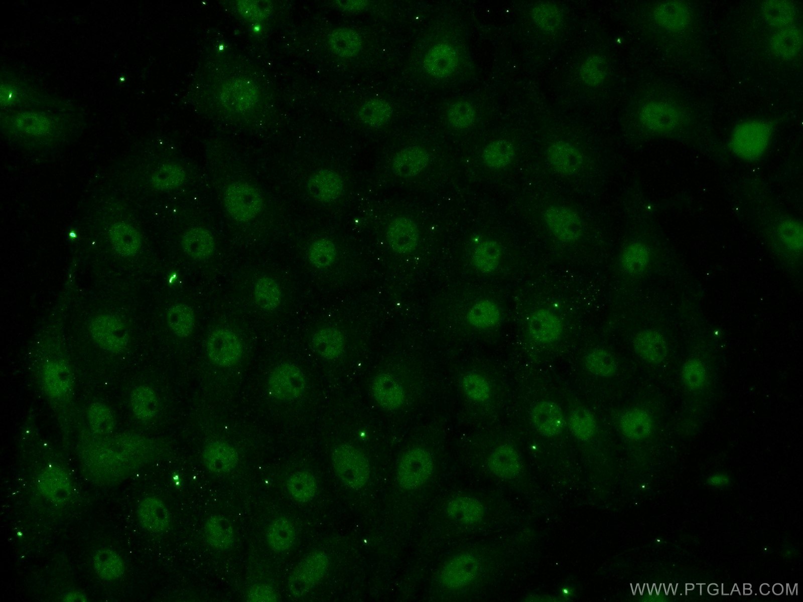 Immunofluorescence (IF) / fluorescent staining of SH-SY5Y cells using EAF1 Polyclonal antibody (13787-1-AP)
