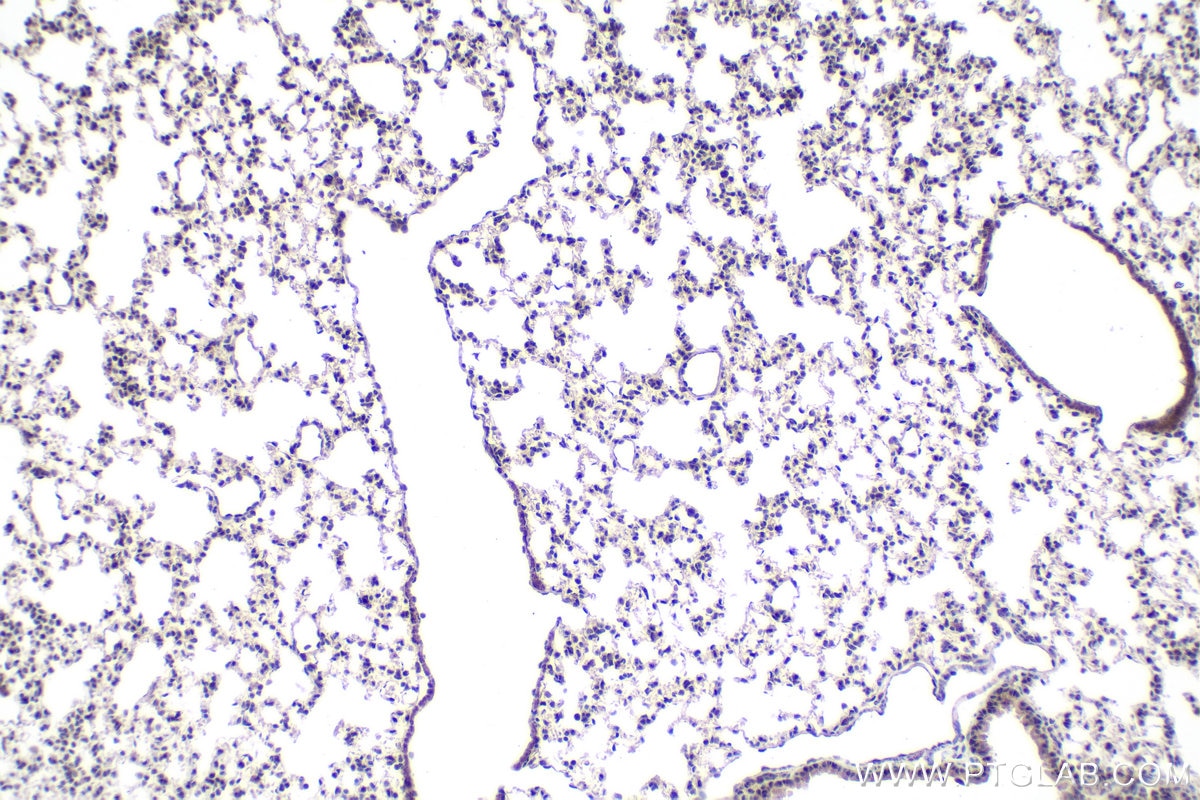 Immunohistochemistry (IHC) staining of mouse lung tissue using EAF1 Polyclonal antibody (13787-1-AP)