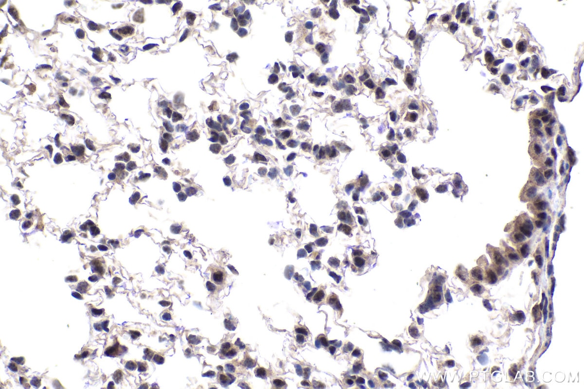 Immunohistochemistry (IHC) staining of mouse lung tissue using EAF1 Polyclonal antibody (13787-1-AP)