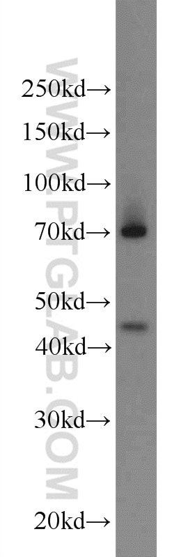 Western Blot (WB) analysis of HeLa cells using EAF1 Polyclonal antibody (13787-1-AP)