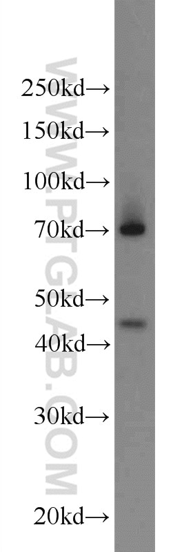 WB analysis of HeLa using 13787-1-AP