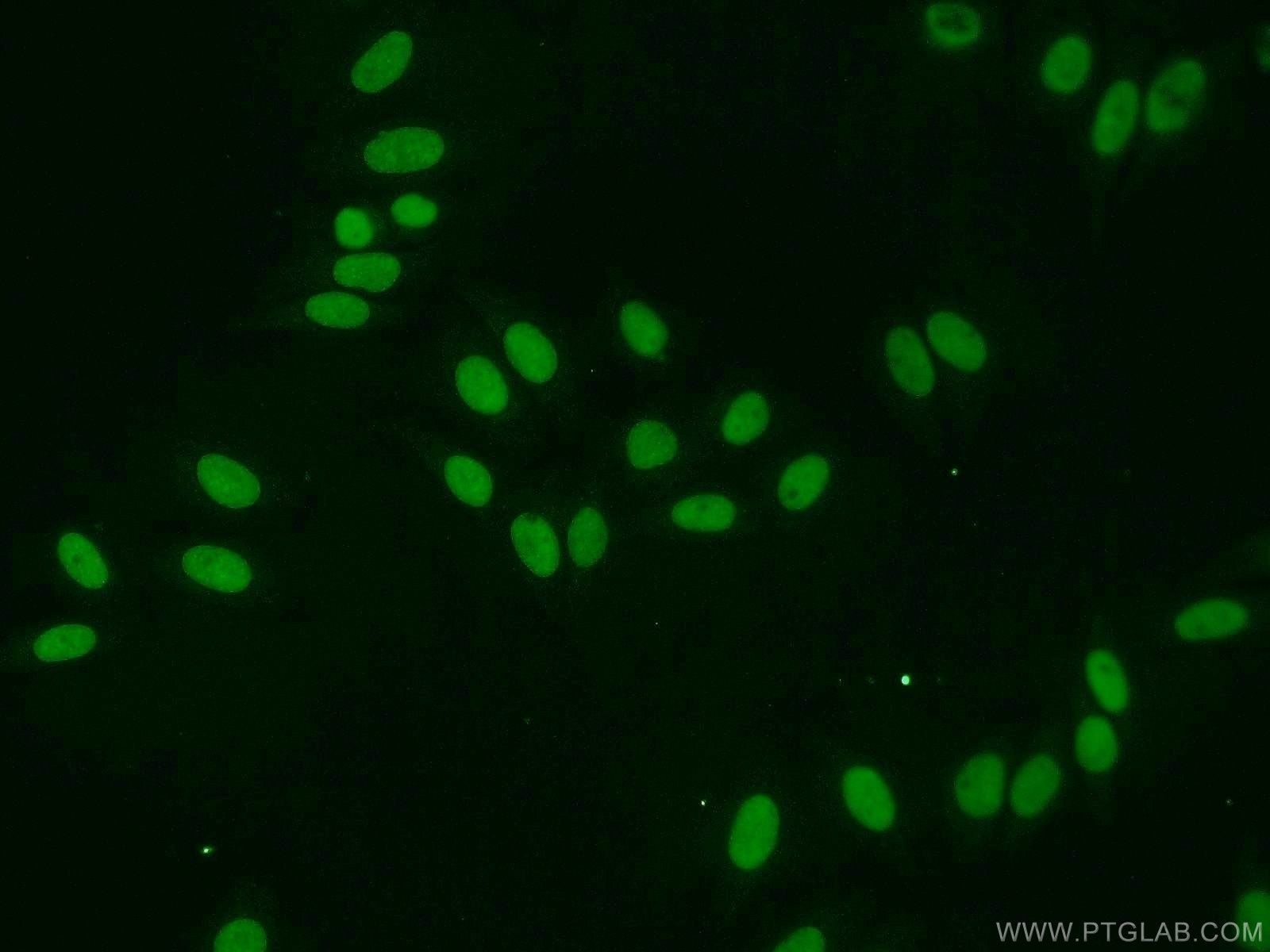 Immunofluorescence (IF) / fluorescent staining of HepG2 cells using EAF2 Polyclonal antibody (11172-1-AP)