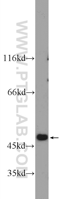 Western Blot (WB) analysis of mouse kidney tissue using EAF2 Polyclonal antibody (11172-1-AP)