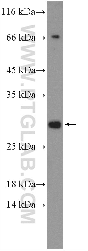 Western Blot (WB) analysis of HeLa cells using EAF6 Polyclonal antibody (26465-1-AP)