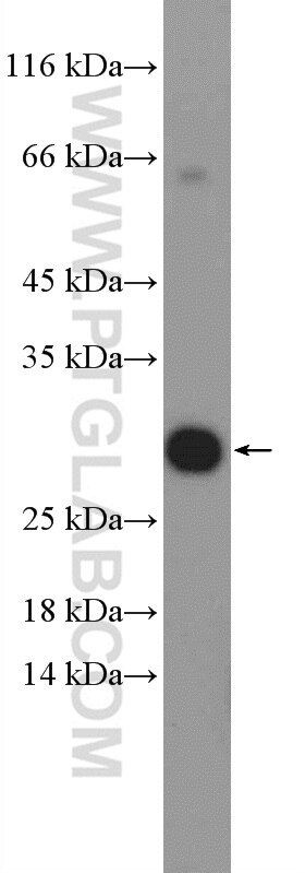 Western Blot (WB) analysis of Jurkat cells using EAF6 Polyclonal antibody (26465-1-AP)
