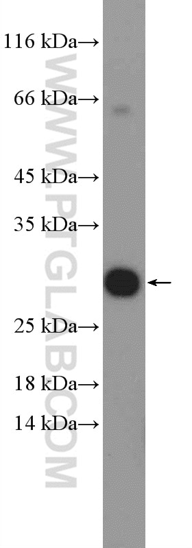 WB analysis of Jurkat using 26465-1-AP