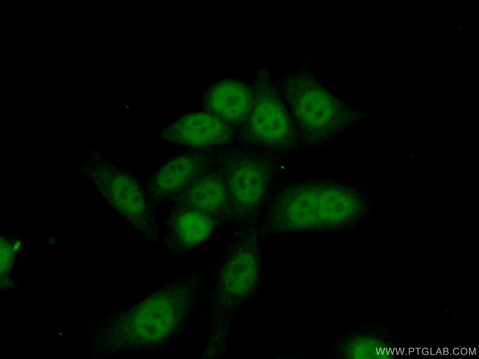 Immunofluorescence (IF) / fluorescent staining of HeLa cells using EAPP Polyclonal antibody (16931-1-AP)