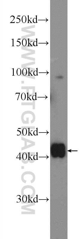 Western Blot (WB) analysis of HeLa cells using EAPP Polyclonal antibody (16931-1-AP)