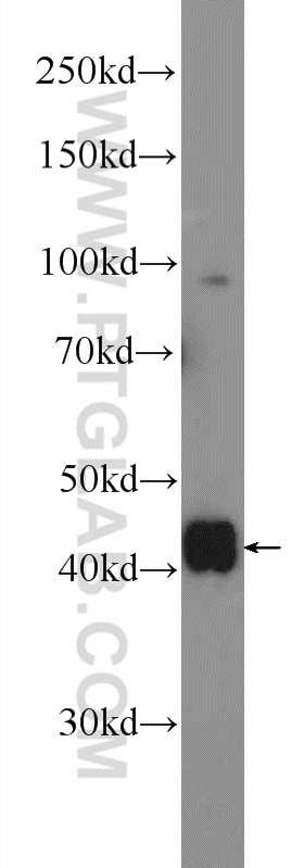 WB analysis of HeLa using 16931-1-AP