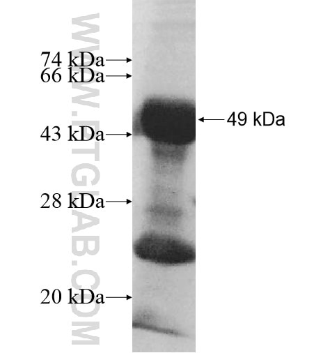 EAPP fusion protein Ag10416 SDS-PAGE
