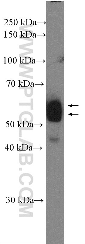Western Blot (WB) analysis of mouse liver mitochondria tissue using EARS2 Polyclonal antibody (17539-1-AP)