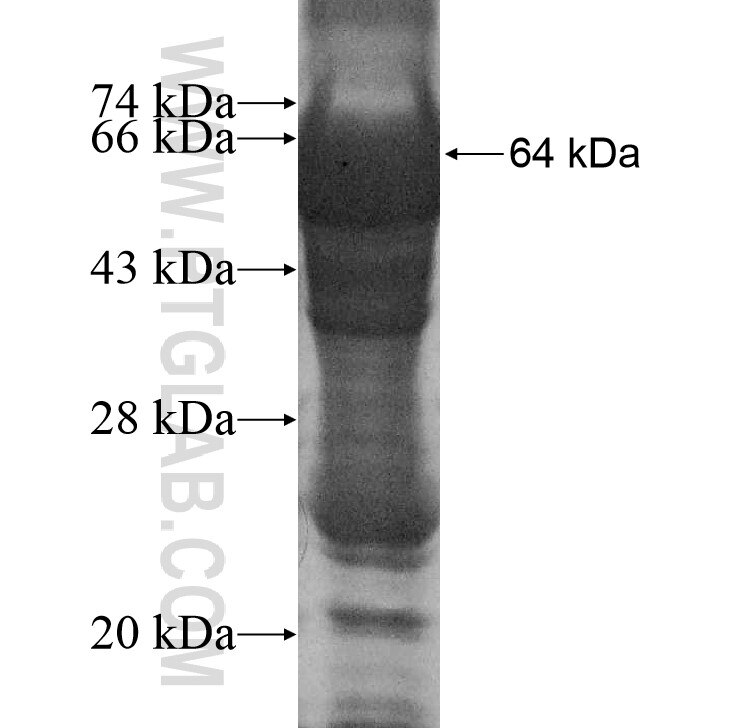 EARS2 fusion protein Ag11594 SDS-PAGE