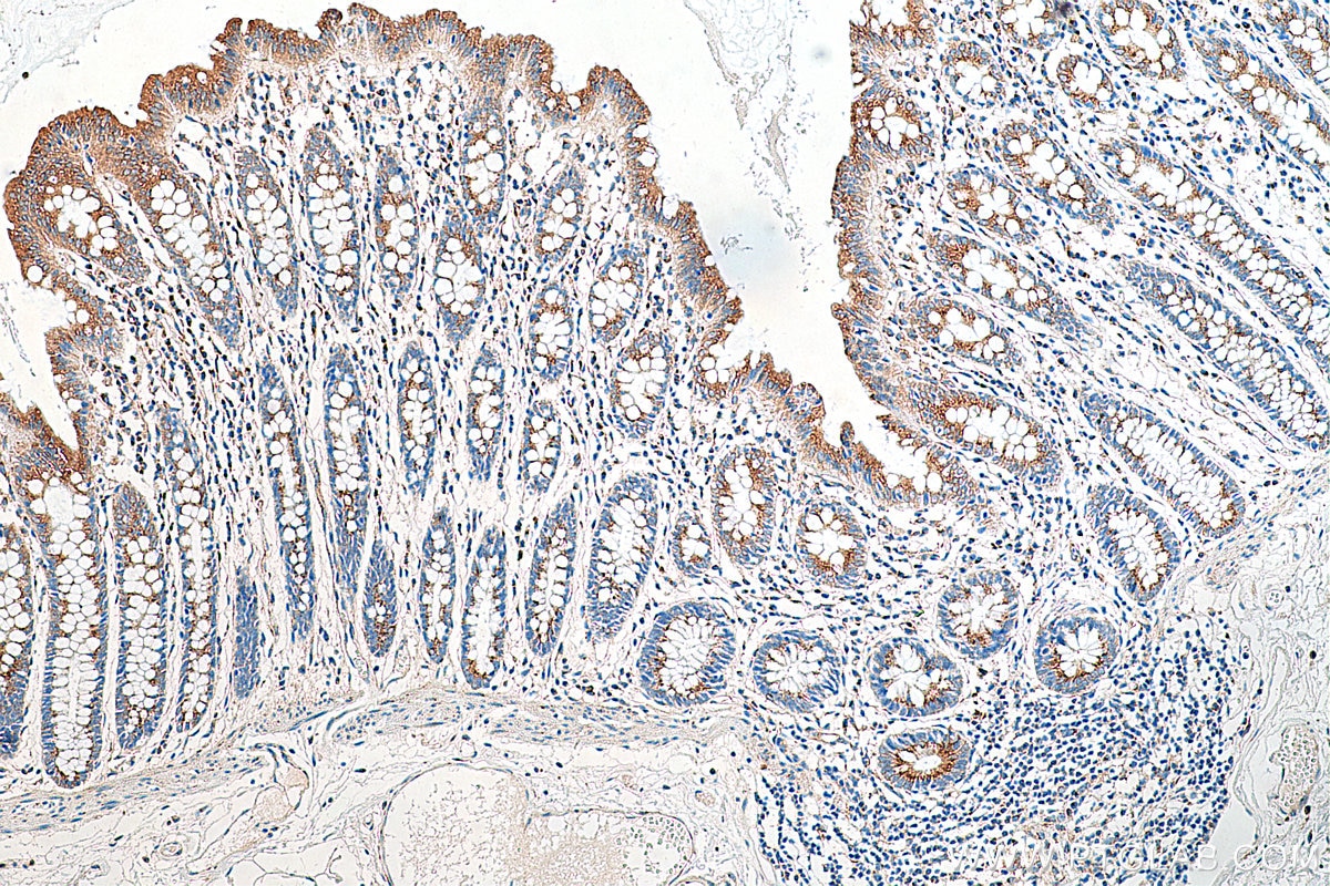 IHC staining of human colon using 12255-1-AP