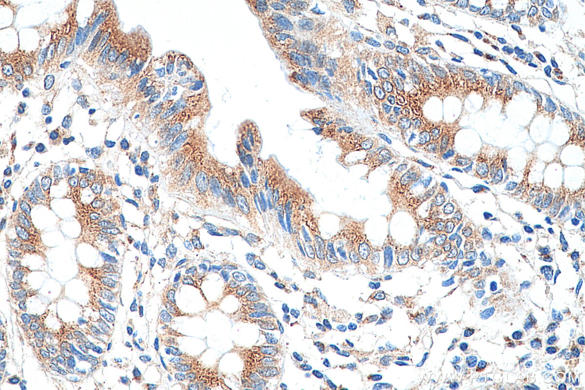 Immunohistochemistry (IHC) staining of human colon tissue using RCAS1 Polyclonal antibody (12255-1-AP)