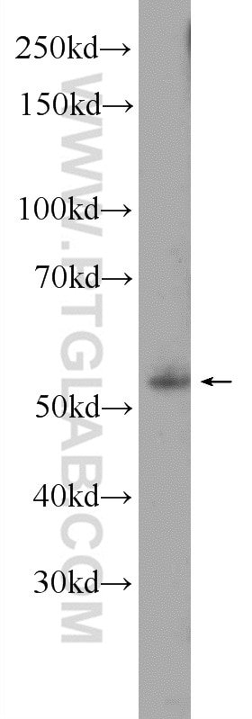 Western Blot (WB) analysis of Raji cells using EBF1 Polyclonal antibody (14159-1-AP)