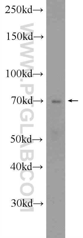 Western Blot (WB) analysis of 3T3-L1 cells using EBF1 Polyclonal antibody (14159-1-AP)