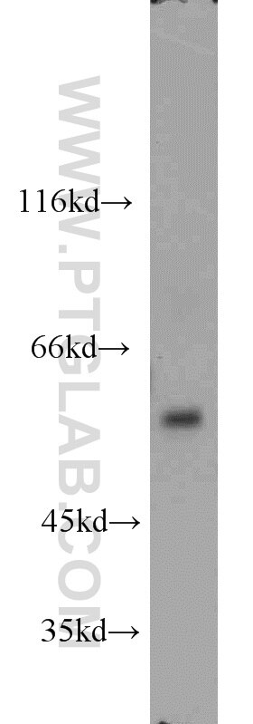 EBF1