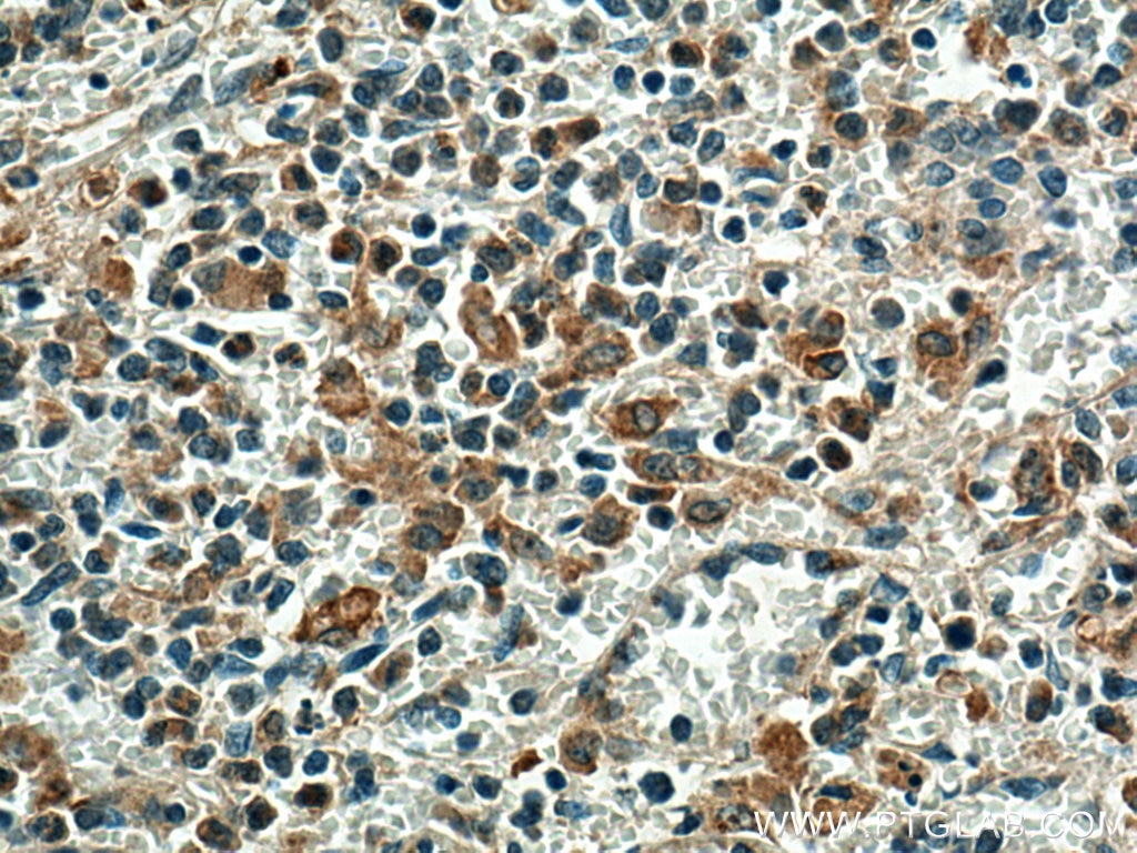 Immunohistochemistry (IHC) staining of human spleen tissue using EBI3 Polyclonal antibody (12371-1-AP)