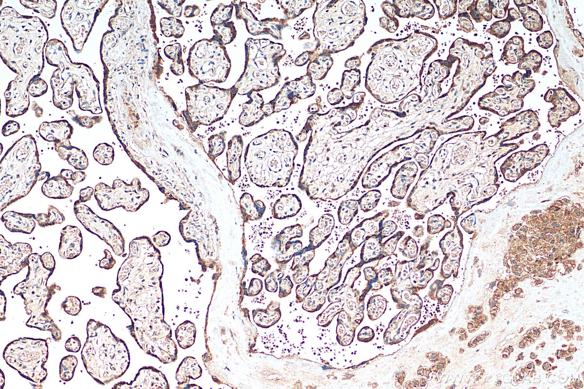 Immunohistochemistry (IHC) staining of human placenta tissue using EBI3 Polyclonal antibody (12371-1-AP)