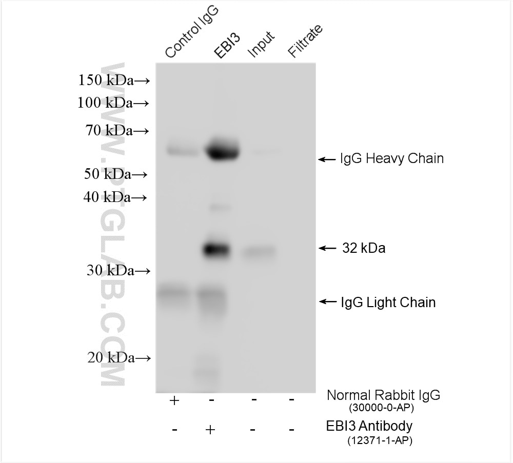 Immunoprecipitation (IP) experiment of human placenta tissue using EBI3 Polyclonal antibody (12371-1-AP)
