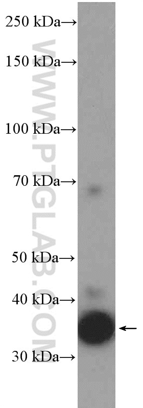 Western Blot (WB) analysis of HEK-293 cells using EBP2 Polyclonal antibody (15973-1-AP)
