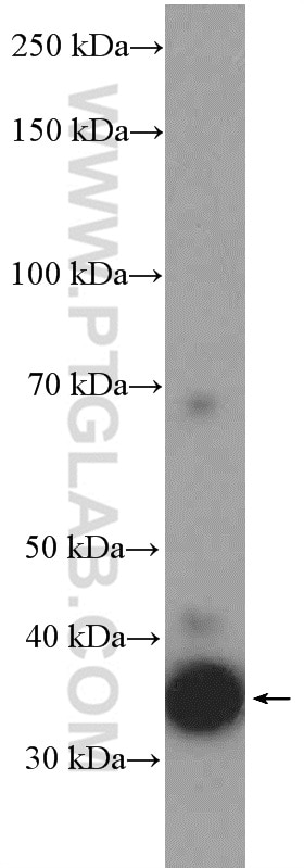 WB analysis of HEK-293 using 15973-1-AP