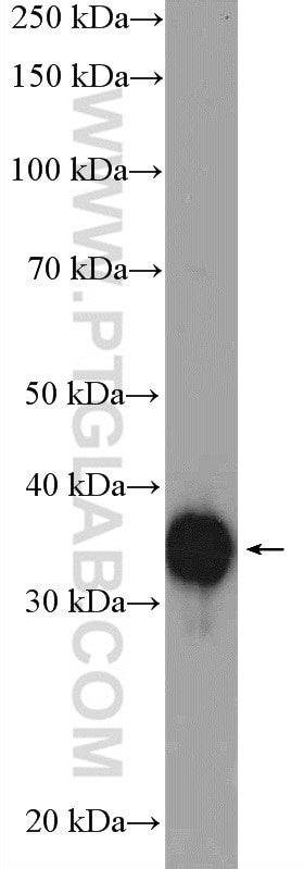 Western Blot (WB) analysis of A549 cells using EBP2 Polyclonal antibody (15973-1-AP)