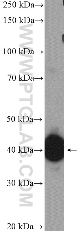 Western Blot (WB) analysis of Raji cells using EBP2 Polyclonal antibody (15973-1-AP)