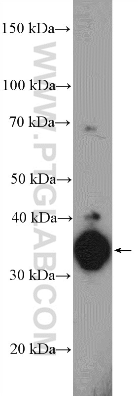 Western Blot (WB) analysis of HeLa cells using EBP2 Polyclonal antibody (15973-1-AP)