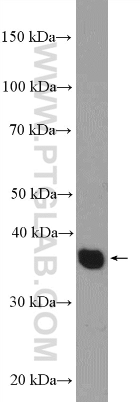 Western Blot (WB) analysis of HEK-293 cells using EBP2 Polyclonal antibody (15973-1-AP)