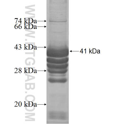 EBP2 fusion protein Ag8833 SDS-PAGE