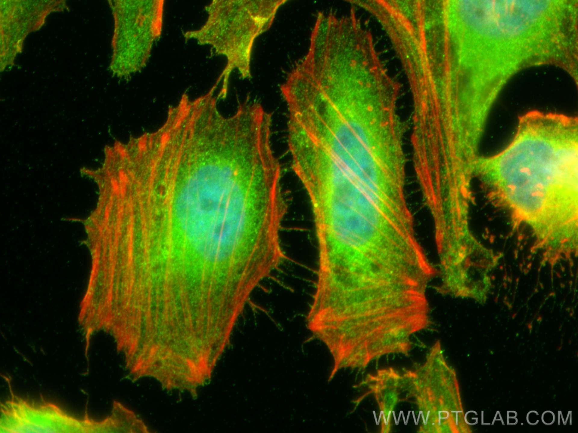 Immunofluorescence (IF) / fluorescent staining of HeLa cells using EBP50/NHERF-1 Polyclonal antibody (29771-1-AP)