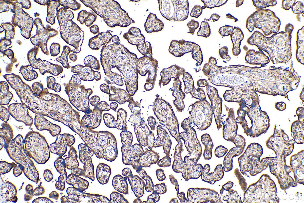 Immunohistochemistry (IHC) staining of human placenta tissue using EBP50/NHERF-1 Polyclonal antibody (29771-1-AP)