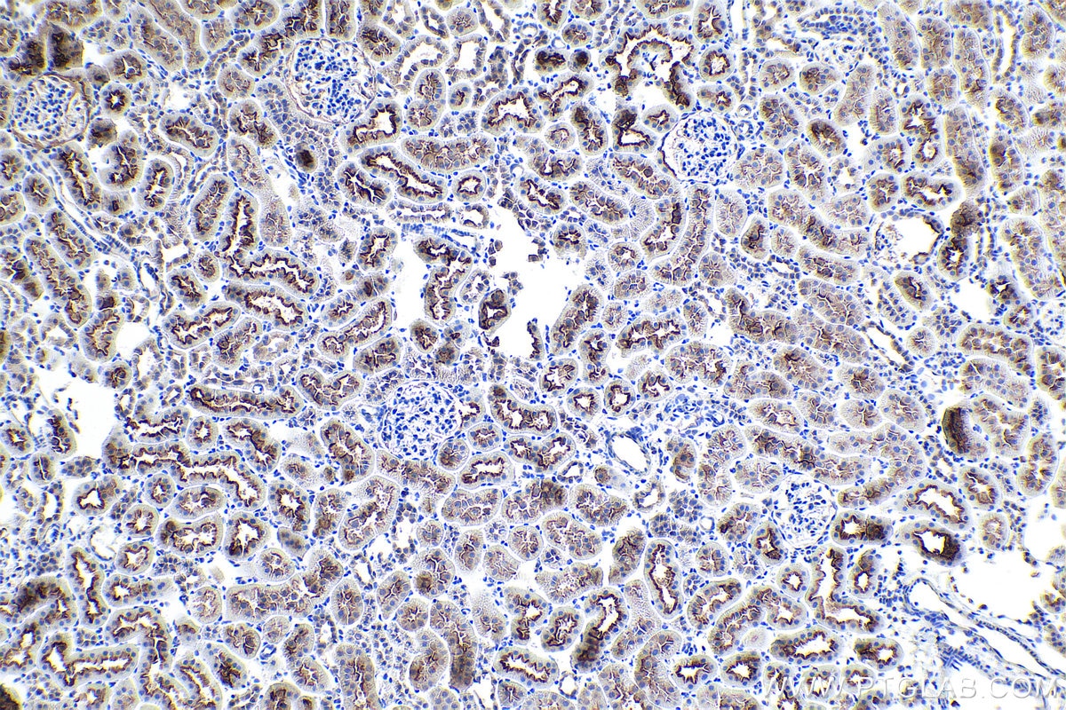 IHC staining of rat kidney using 29771-1-AP