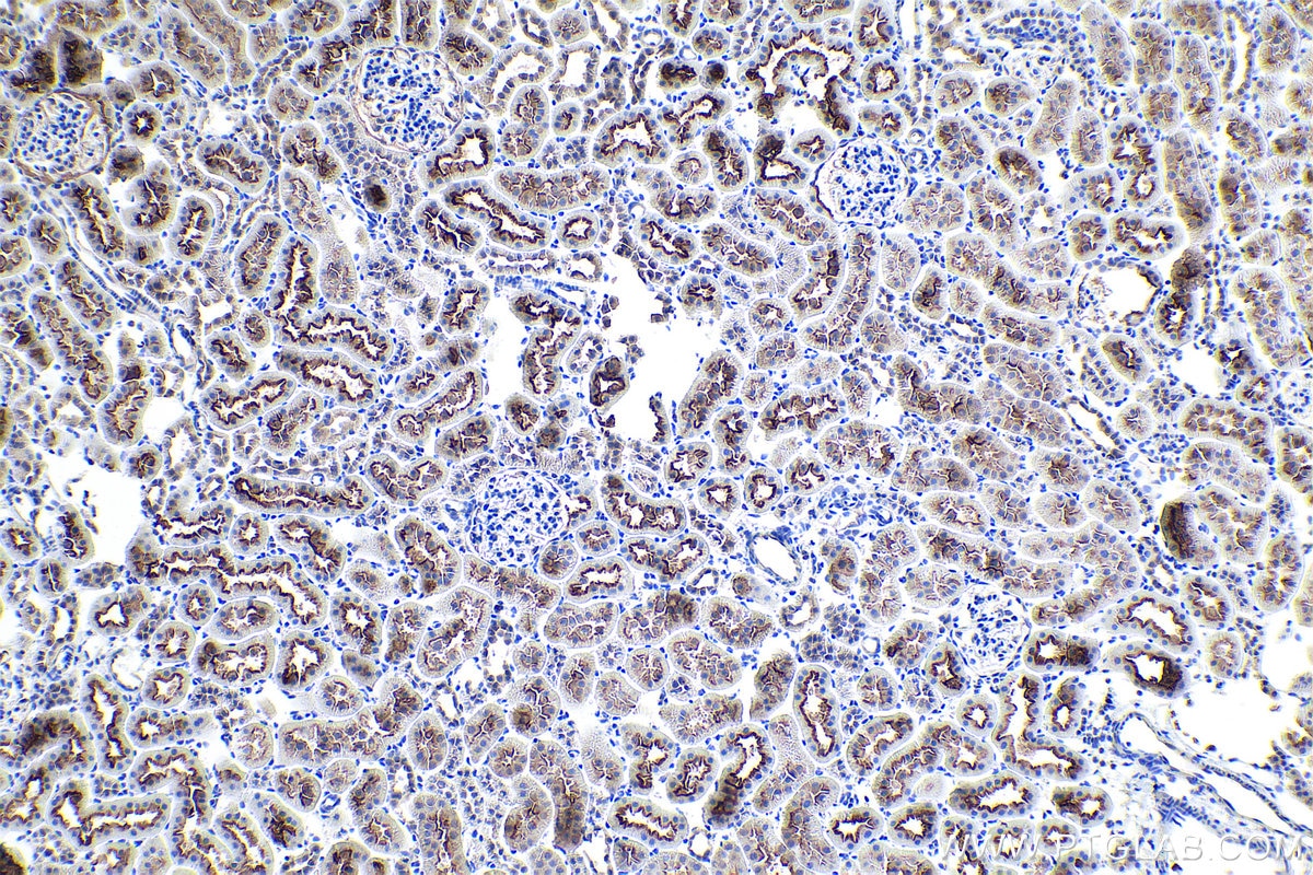 Immunohistochemistry (IHC) staining of rat kidney tissue using EBP50/NHERF-1 Polyclonal antibody (29771-1-AP)