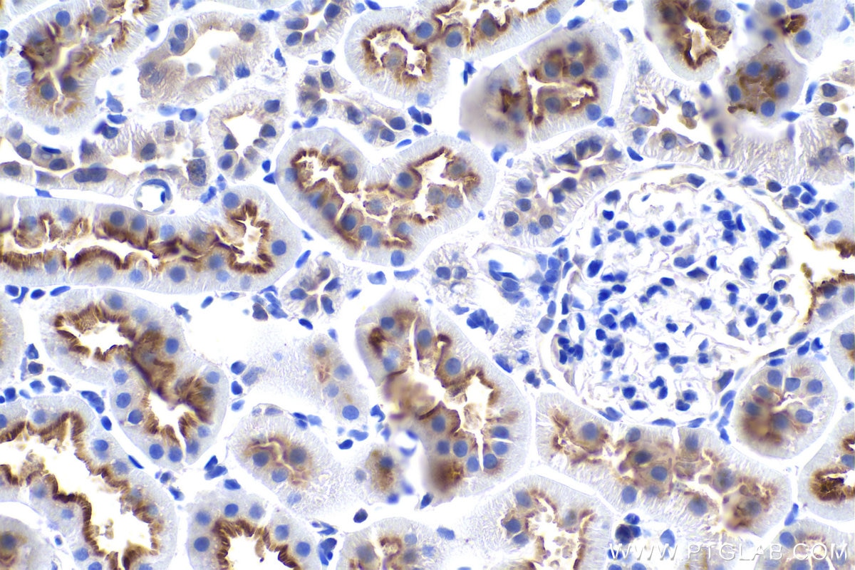 Immunohistochemistry (IHC) staining of rat kidney tissue using EBP50/NHERF-1 Polyclonal antibody (29771-1-AP)